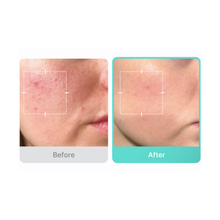 Load image into Gallery viewer, Medicube Azelaic Acid 16 BB Calming Serum - 30ml