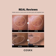 Load image into Gallery viewer, Cosrx - The Alpha-Arbutin 2 Discoloration Care Serum