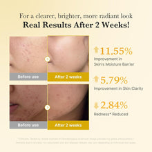 Load image into Gallery viewer, medicube - Kojic Acid Turmeric Niacinamide Serum - 30ml