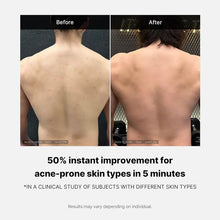 Load image into Gallery viewer, Medicube Red Acne Body Wash - 400ml