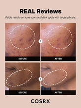 Load image into Gallery viewer, Cosrx - The Alpha-Arbutin 2 Discoloration Care Serum
